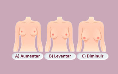 O que você gostaria de melhorar nos seus seios?